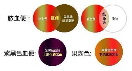 广州9博中国体育东大肛肠医院骗人吗黑猫投诉出现血便误以为是痔疮！直到体重下降近5公斤才发现异常！(图4)